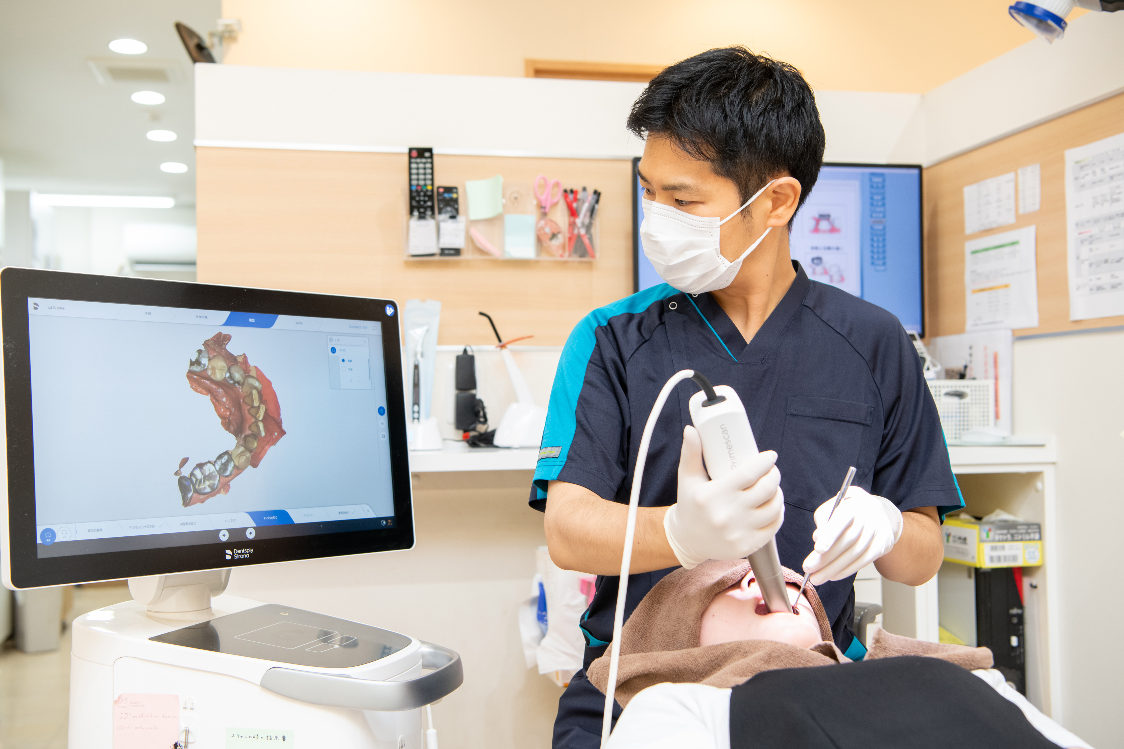 口腔内スキャナー