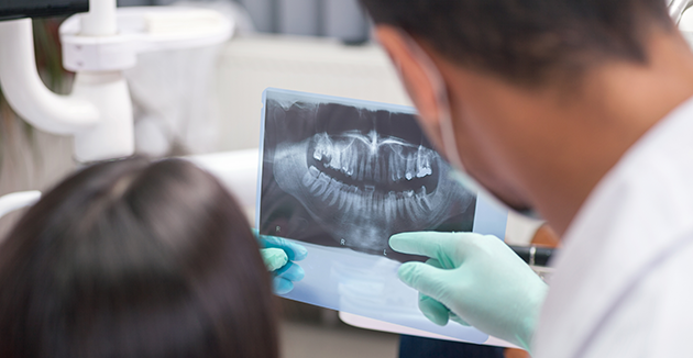 良性腫瘍・嚢胞