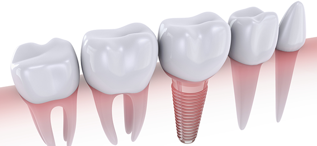 高圧蒸気滅菌器イメージ