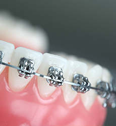 キッズルームイメージ